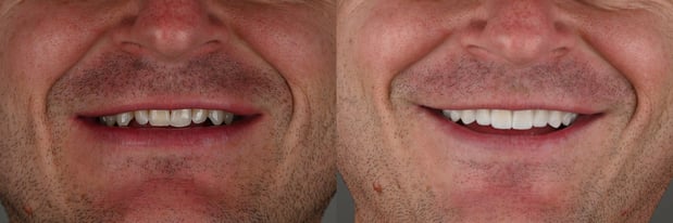 Images Hoopes Dental