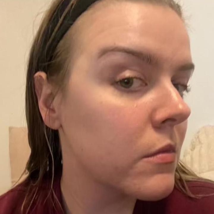 Images DERMA GLOW SOUTH YARRA ( Formerly Known as ALS)