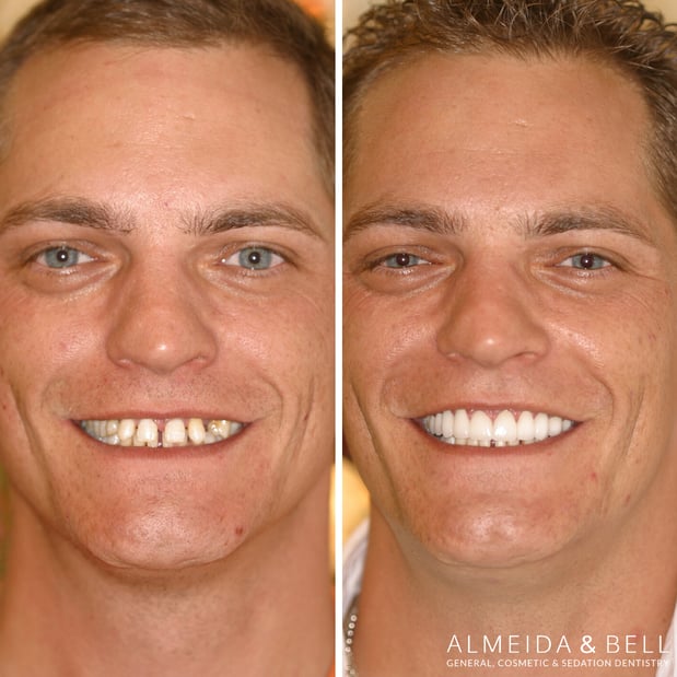 Images Almeida & Bell Dental Lone Tree - General, Cosmetic, and Implant Dentistry