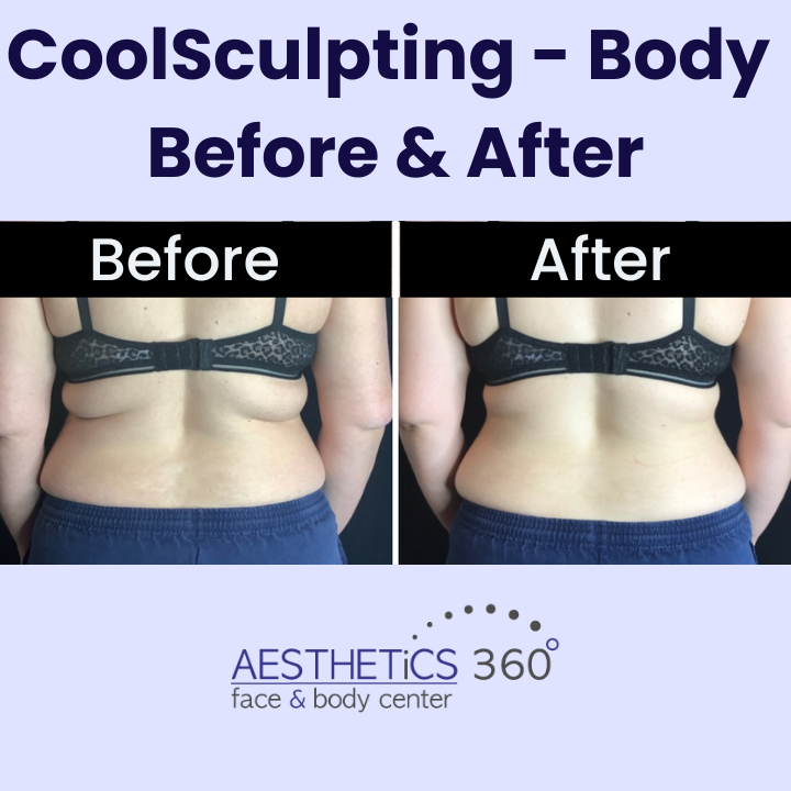 Images AESTHETICS 360° Face & Body Center