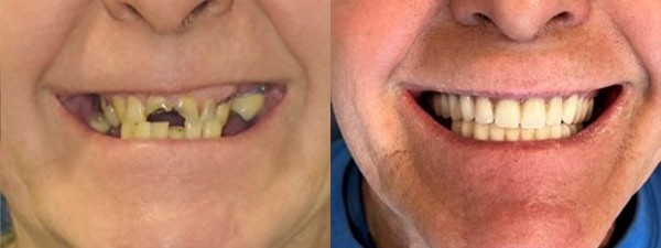 Images Riverside Family Dental