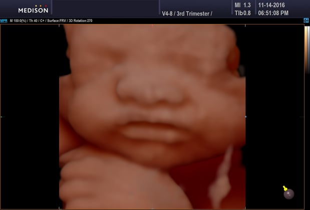 Images Heavenly 3D 4D Ultrasounds