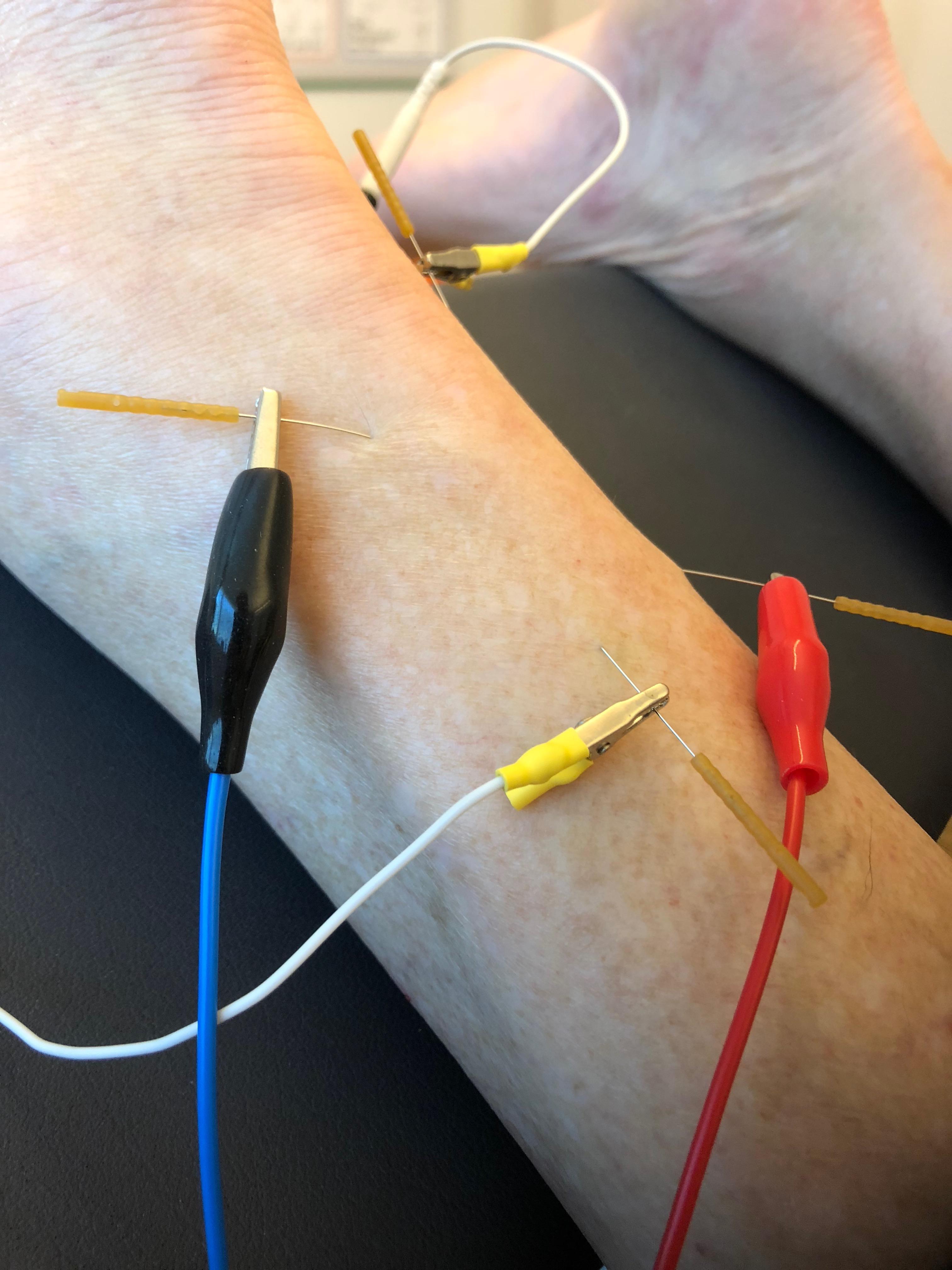 physio help, Lückhalde 14 in Muri b. Bern