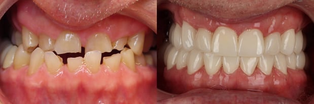 Images LaFayette Dental Associates