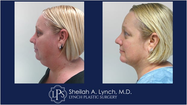 Images Dr. Sheilah A. Lynch