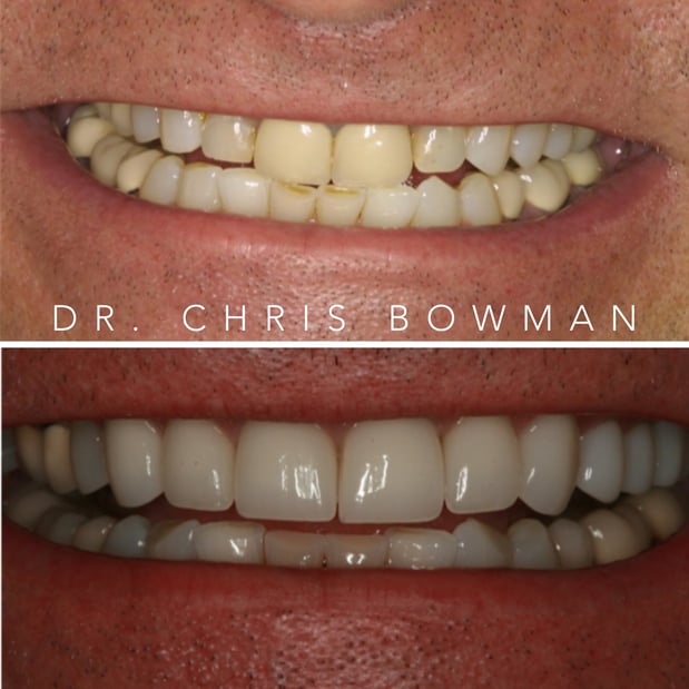 Images Advanced Dentistry of Charlotte