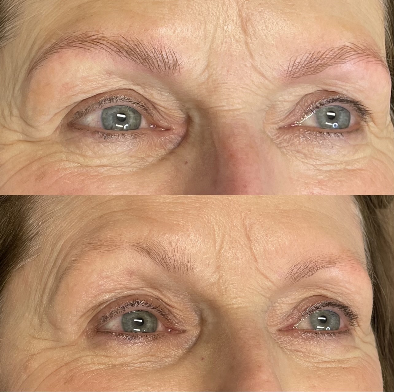 Images Clinique d'Esthétique Leila - Hydrafacial, Microblading, Épilation Laser Sainte-Foy