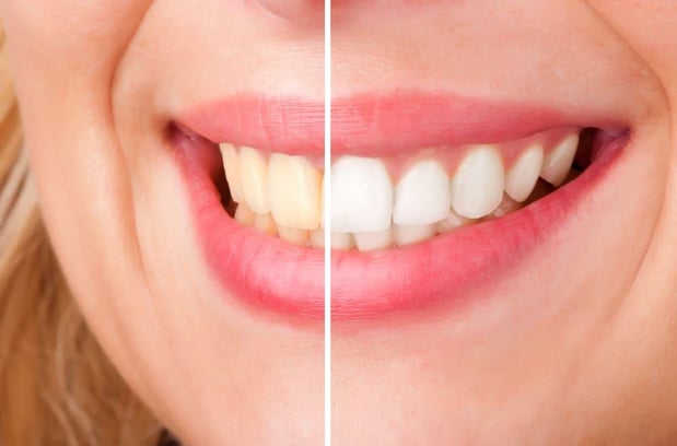 Images Eagle Rock Dental Care