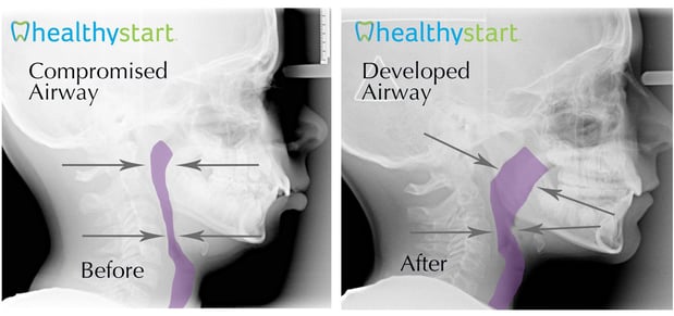 Images Lifetime Dental & Fastbraces