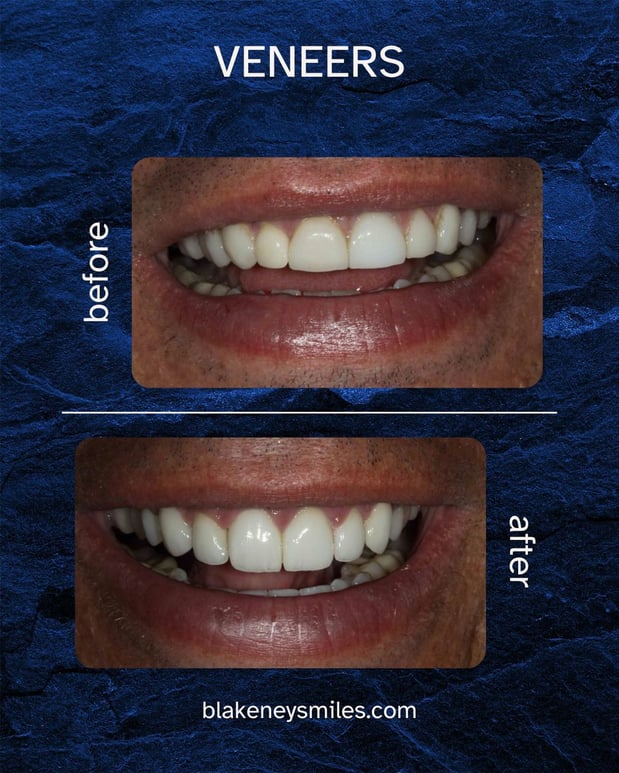 Images Advanced Dentistry of Blakeney