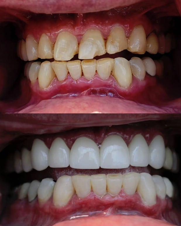Images Smiles By Eddie: Dr. Edmond Ahdoot DDS
