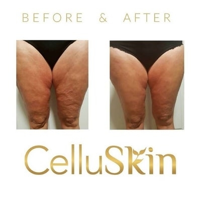 Images Onyx Esthétique - Soins esthétiques, Soins de la peau, Laser Cynosure Gatineau