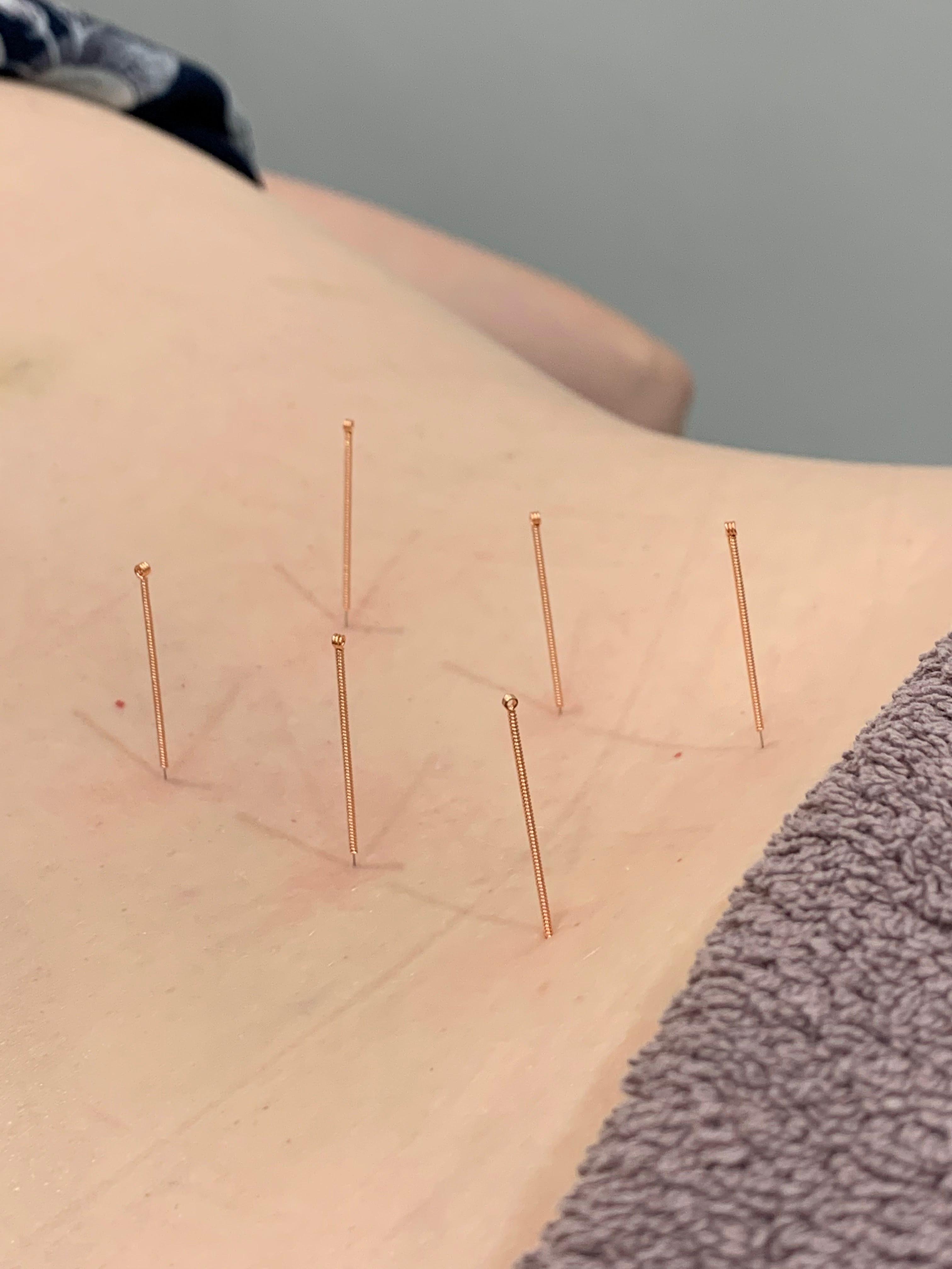 Images Alex Mendieta Chiropractic