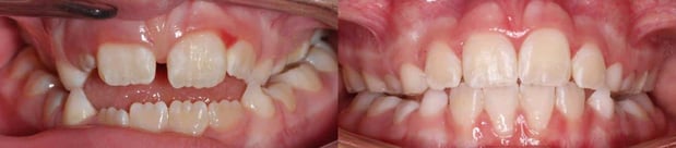 Images TLC Pediatric Dentistry and Orthodontics