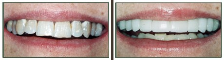 Images Tierrasanta Plaza Dental