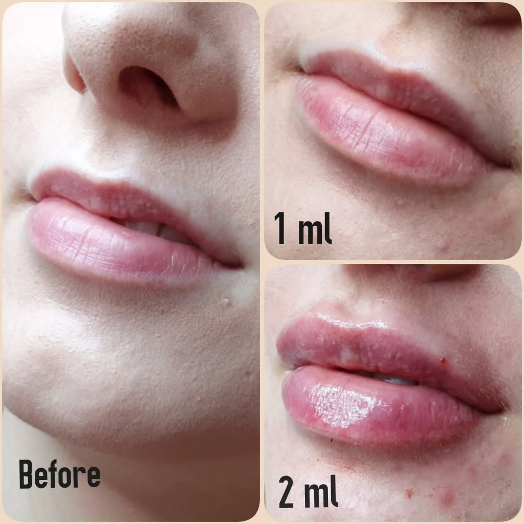 Images Lincoln Aesthetic