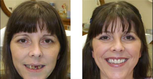 Images Northeast Lincoln Family Dentistry