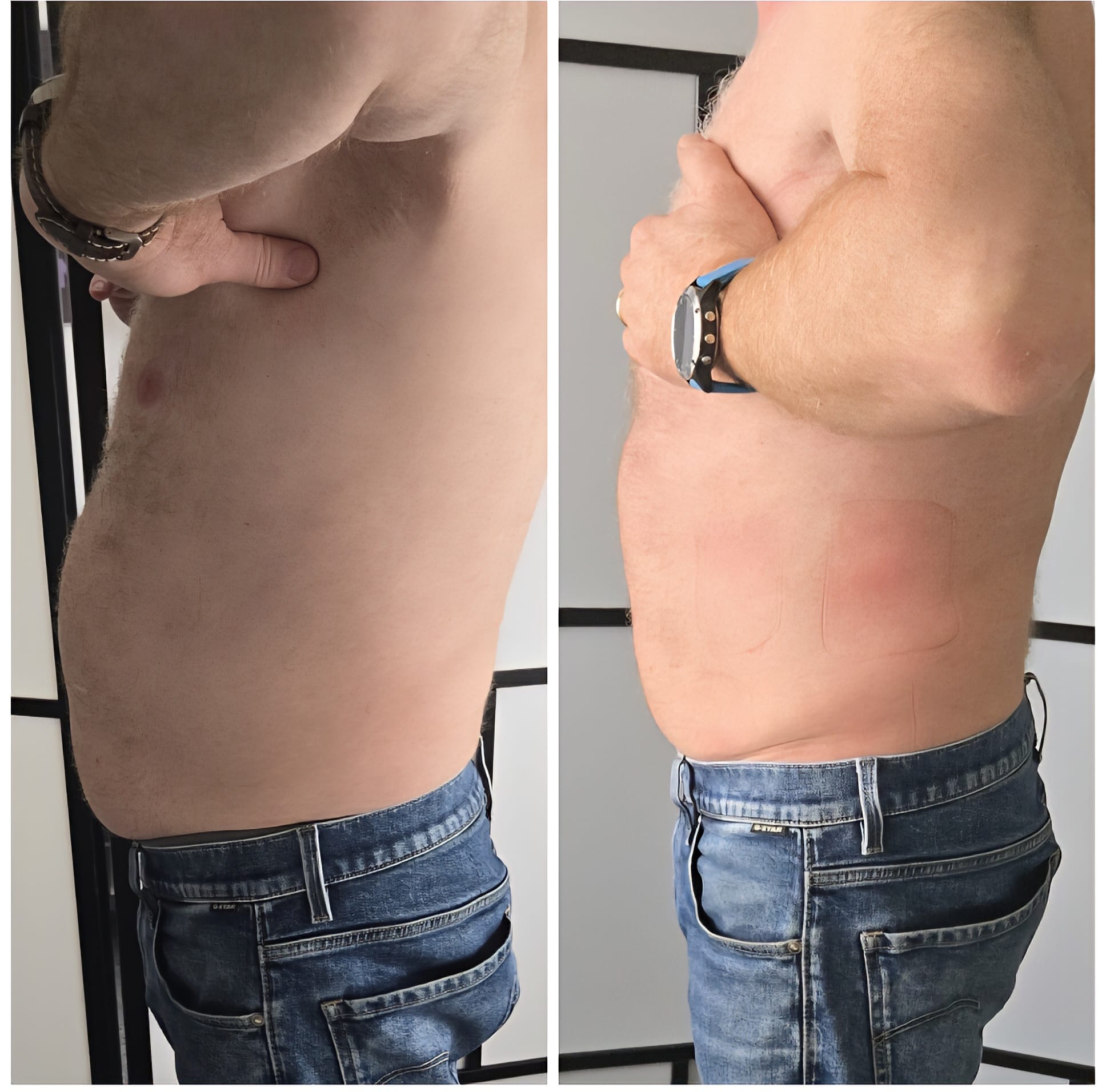 Bilder Abnehmen im liegen St Gallen