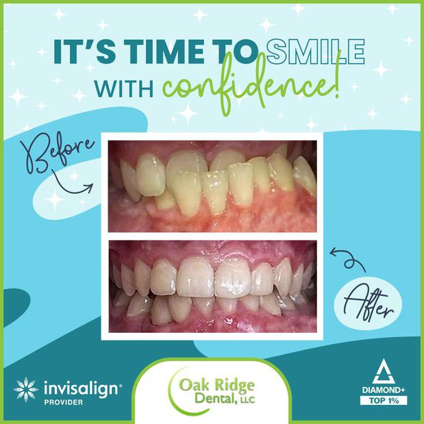 Images Oak Ridge Dental