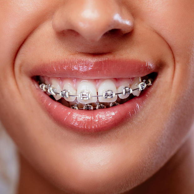 Images Elite Pediatric Dentistry – Fairfax