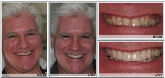 Results of Exton Dental Health Group | Exton, PA