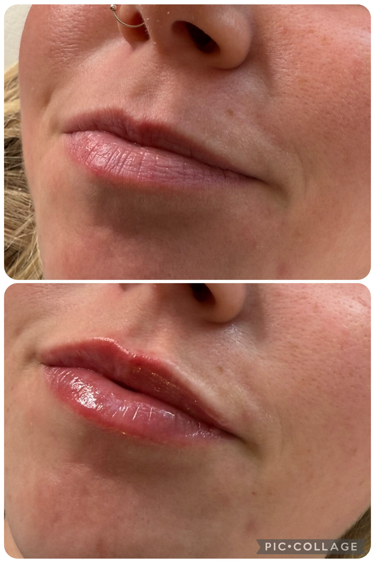 Images Harvey Medical Aesthetics