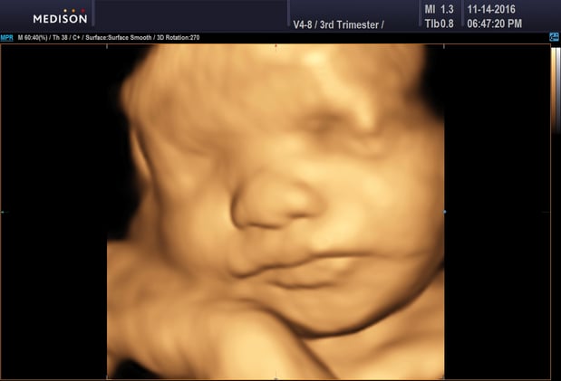 Images Heavenly 3D 4D Ultrasounds