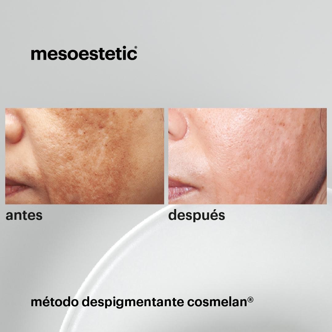 Images Sabina Leonte Centro de Estética Avanzada Montecarmelo