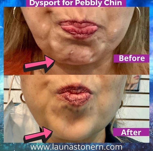 Images Launa Stone, R.N.