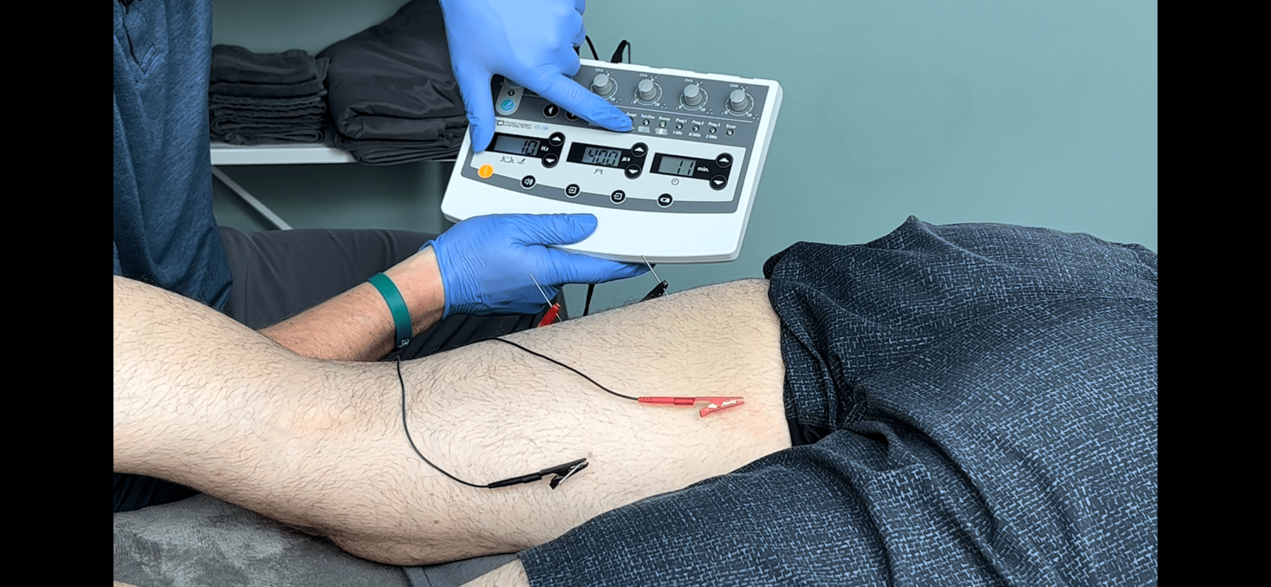 Lower Quadrant Dry Needling by ICE brings a modern approach to dry needling education with contemporary methods and tactical e-stim applications for the lower quadrant.