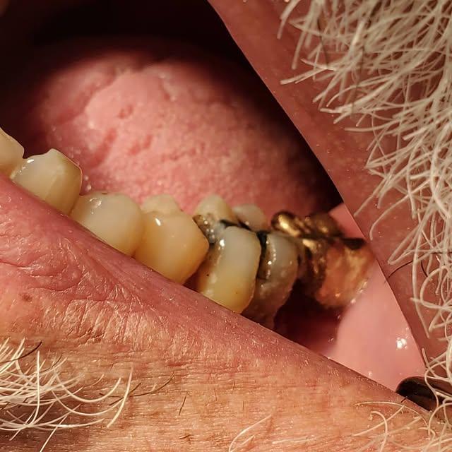 Images Smiles By Eddie: Dr. Edmond Ahdoot DDS