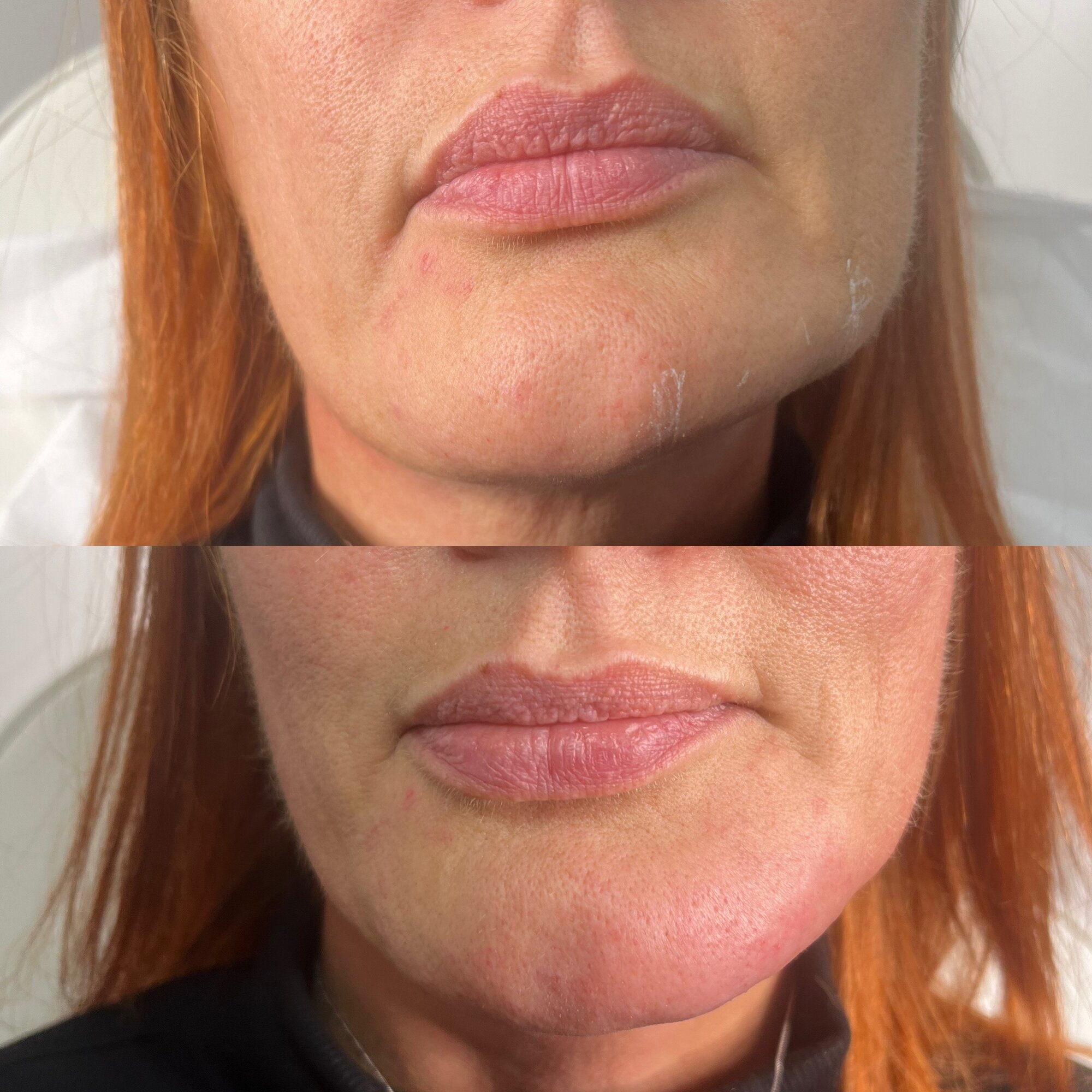 Images Harvey Medical Aesthetics