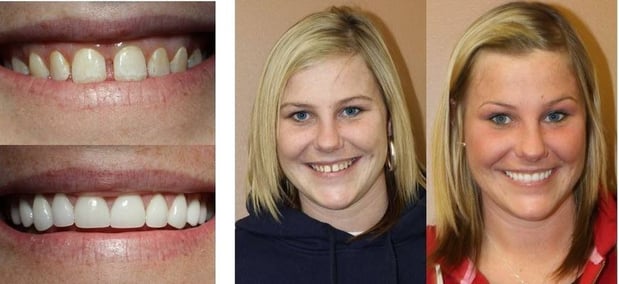 Images Simply Dental of Fishers