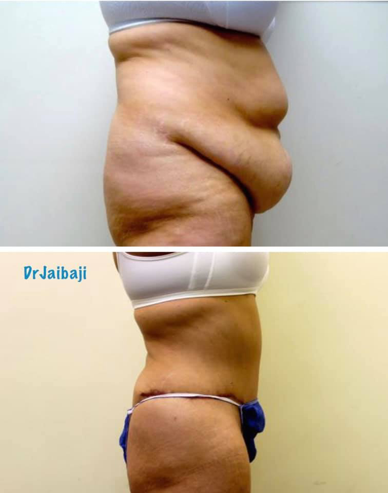 Jaibaji Plastic Surgery Photo