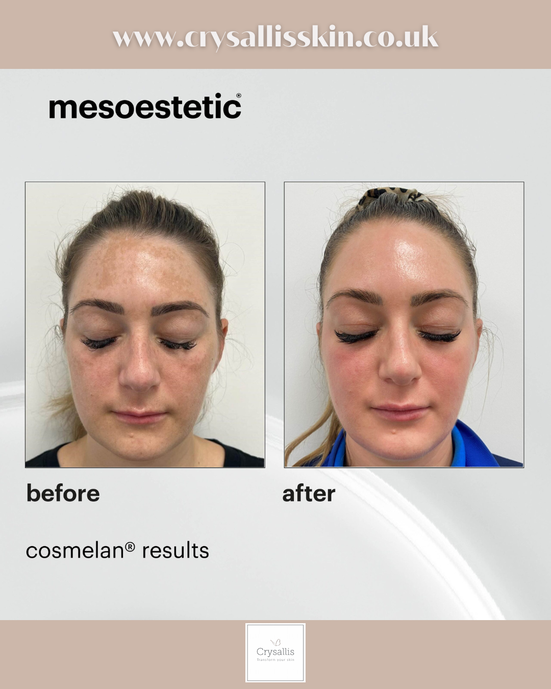 Images Crysallis Skin Clinic