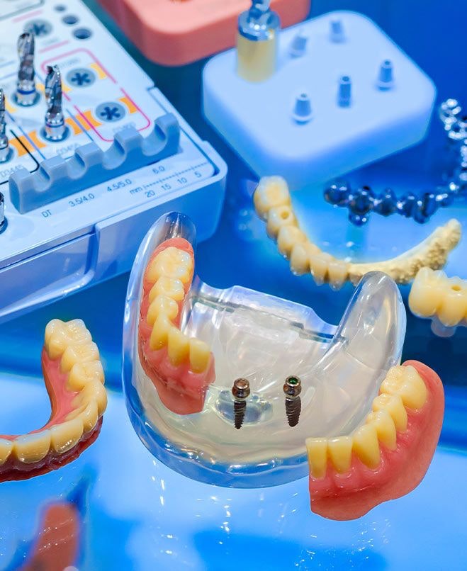 Southern Dental Implant Center | Cordova, TN, , Dentist